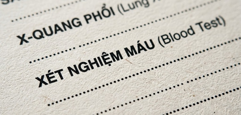 Cận cảnh chất liệu giấy Ford bám mực tốt dùng để in hồ sơ y tế